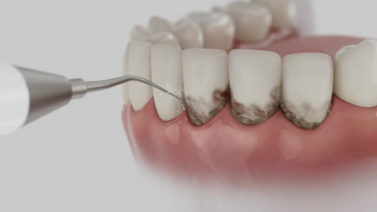 Reliable Dental Implants contractor in Collinsville, MS by Smile Center Dentistry